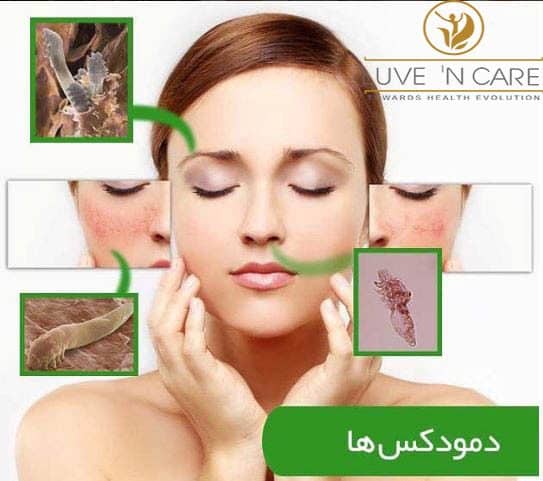 دمودکس و ریزش مو