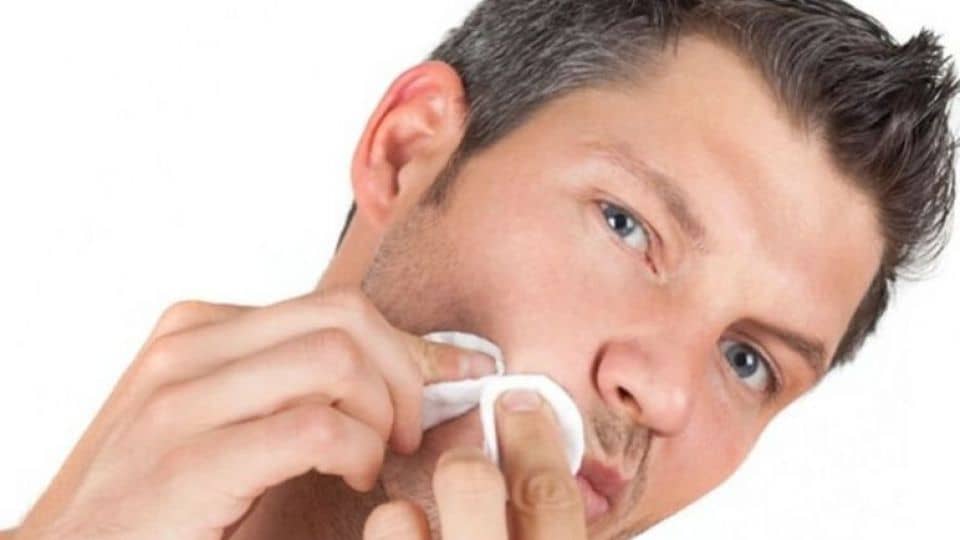 جوش و درمان آن