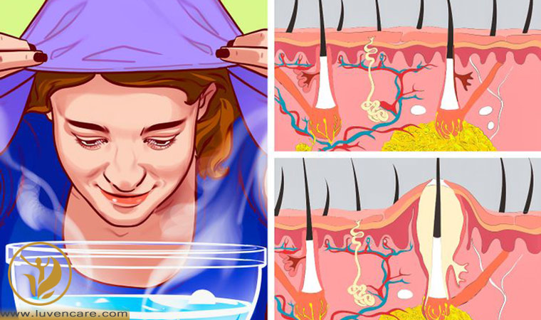 باز شدن منافذ پوست