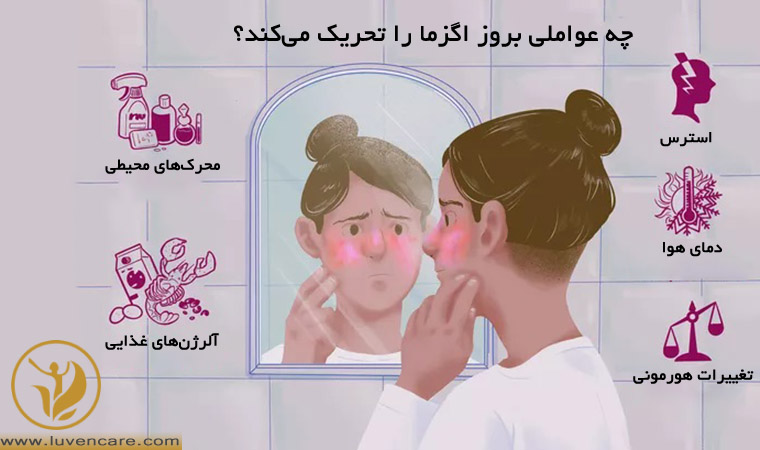 تحریک اگزما