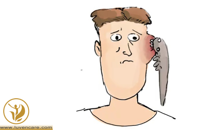 علائم دمودکس در صورت