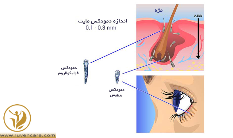 انواع دمودکس چشم
