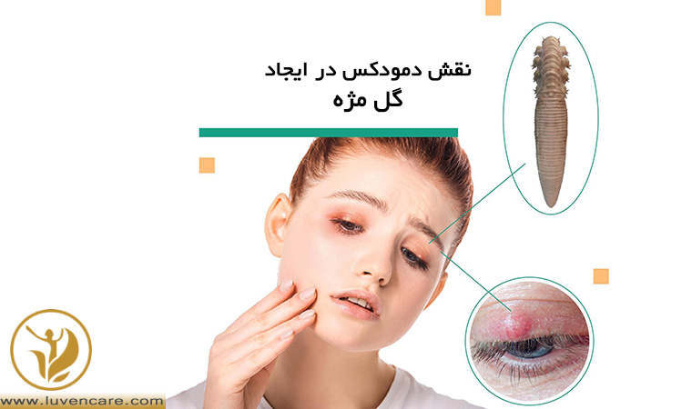 نقش دمودکس در ایجاد گل مژه