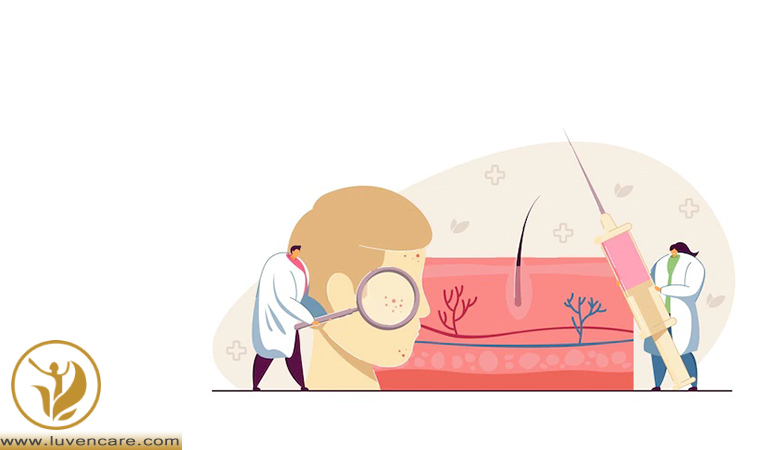 درمان التهاب پوست صورت