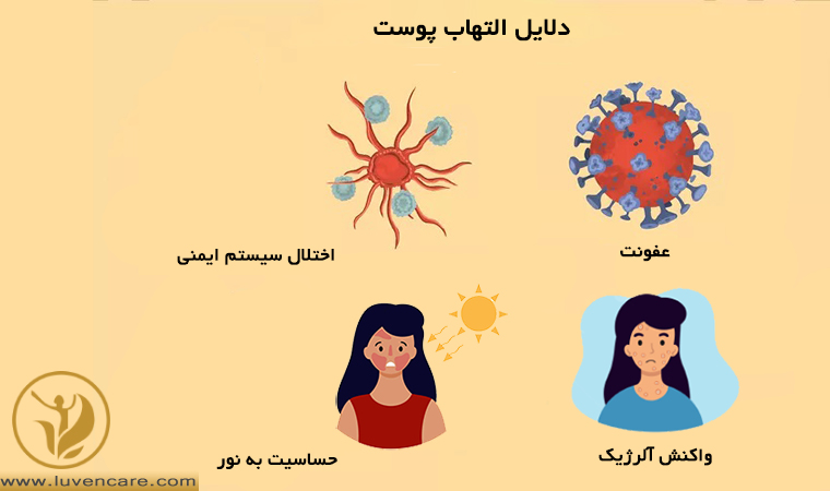 دلایل التهاب پوست صورت