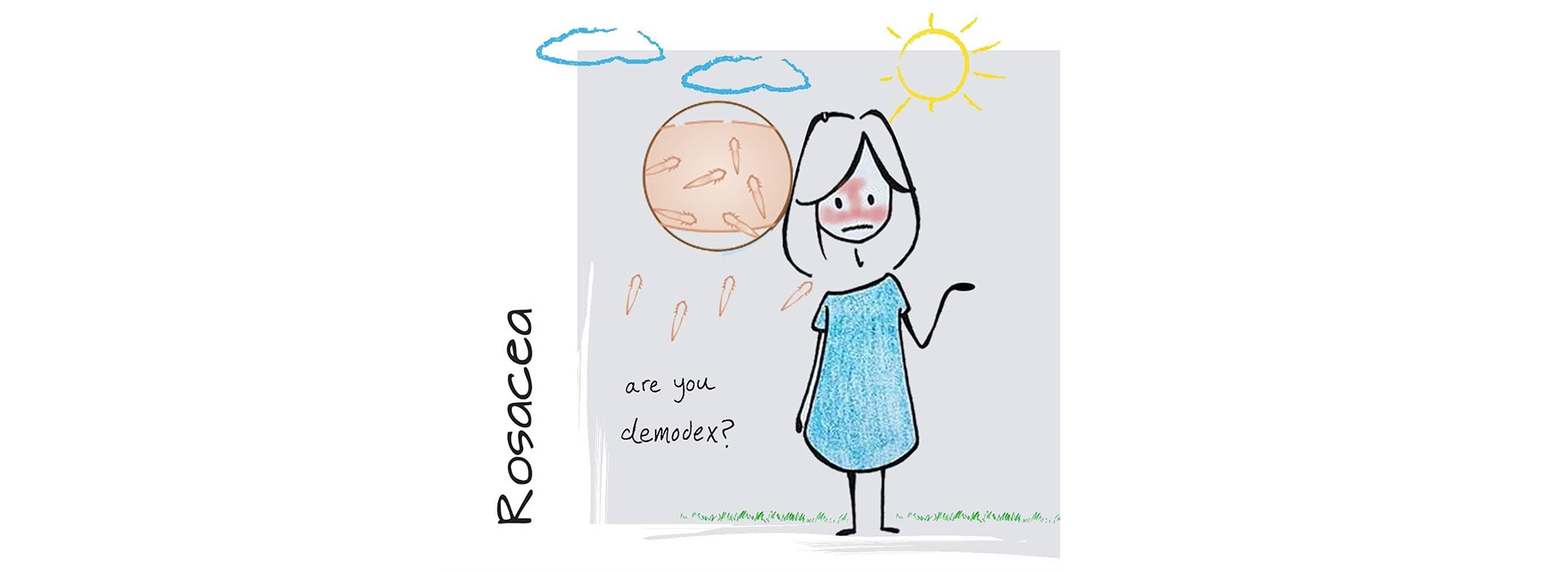 درمان خانگی روزاسه درمان خانگی روزاسه